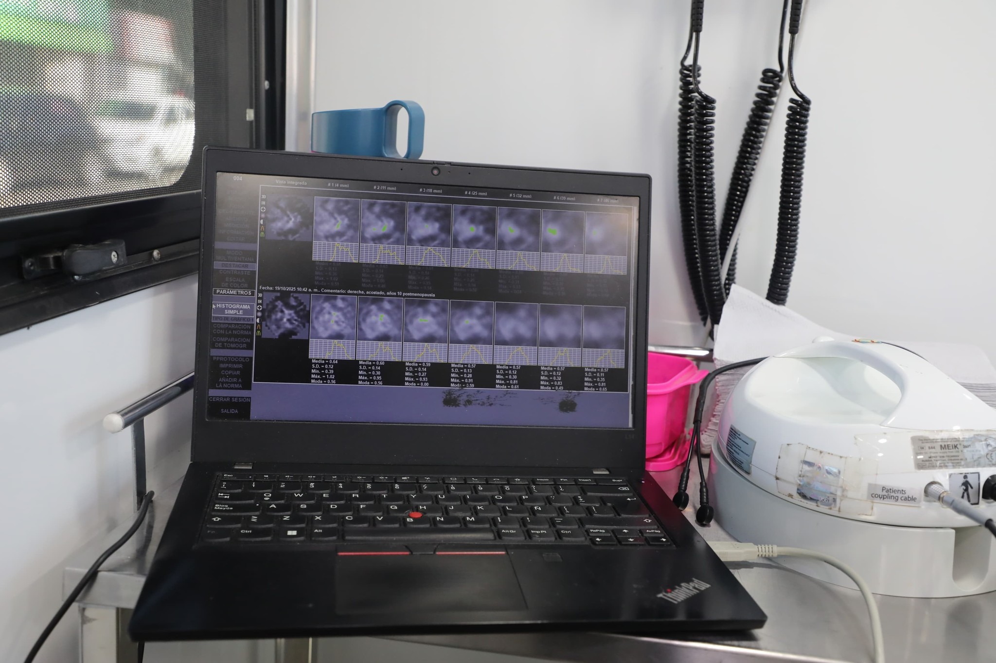 Semana Rosa Prevencion Deteccion Cancer Mama Tlalntepantla 11